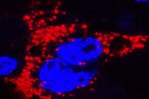How Zika infects fetus
