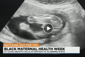 Wash U doctor: Black women are 3 times more likely to die during pregnancy, child birth