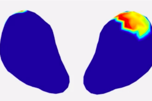 Associate Professor of ObGyn, Yong Wang, on developing new imaging technology
