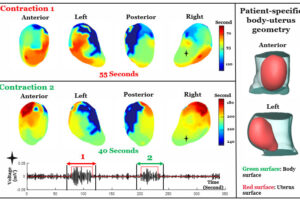 Dr. Wang cited in “New, non-invasive imaging tool maps uterine contractions during labor”